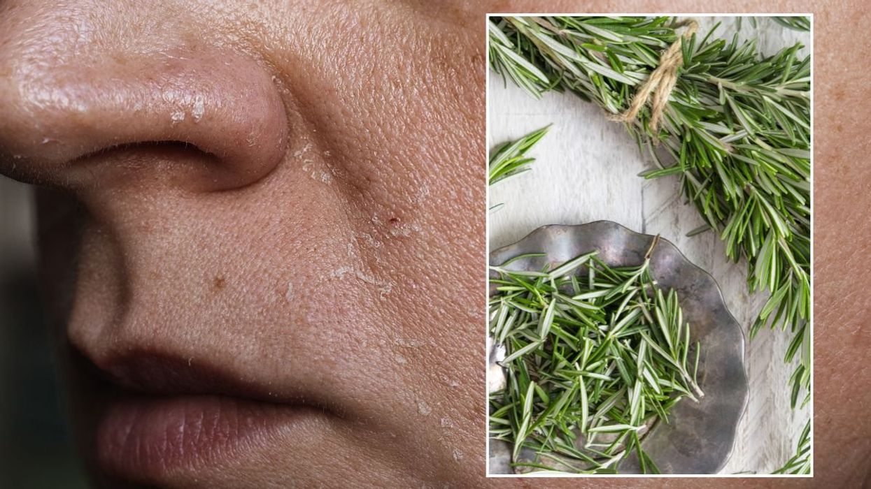 SKIN CARE ROSEMARY
