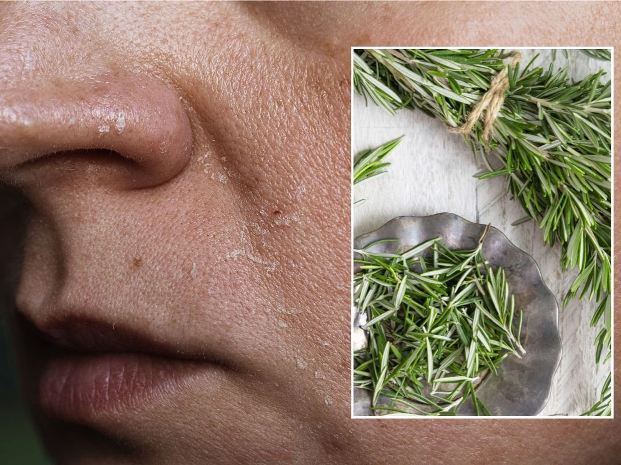 SKIN CARE ROSEMARY