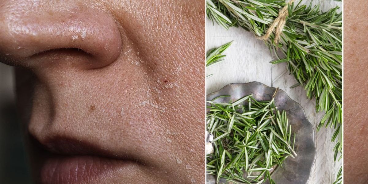 TikTok skin care hack backed by science as researchers find it boosts ‘skin regeneration’ and stops scarring TikTok skin care hack backed by science as researchers find it boosts ‘skin regeneration’ and stops scarring