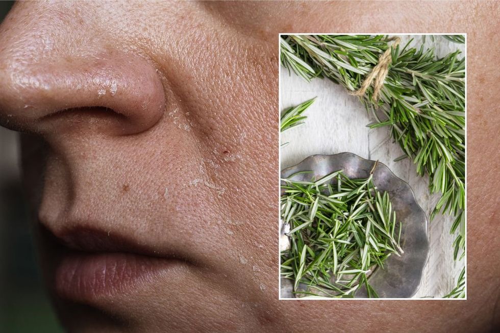 SKIN CARE ROSEMARY