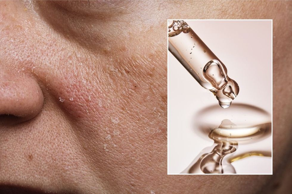 skin care