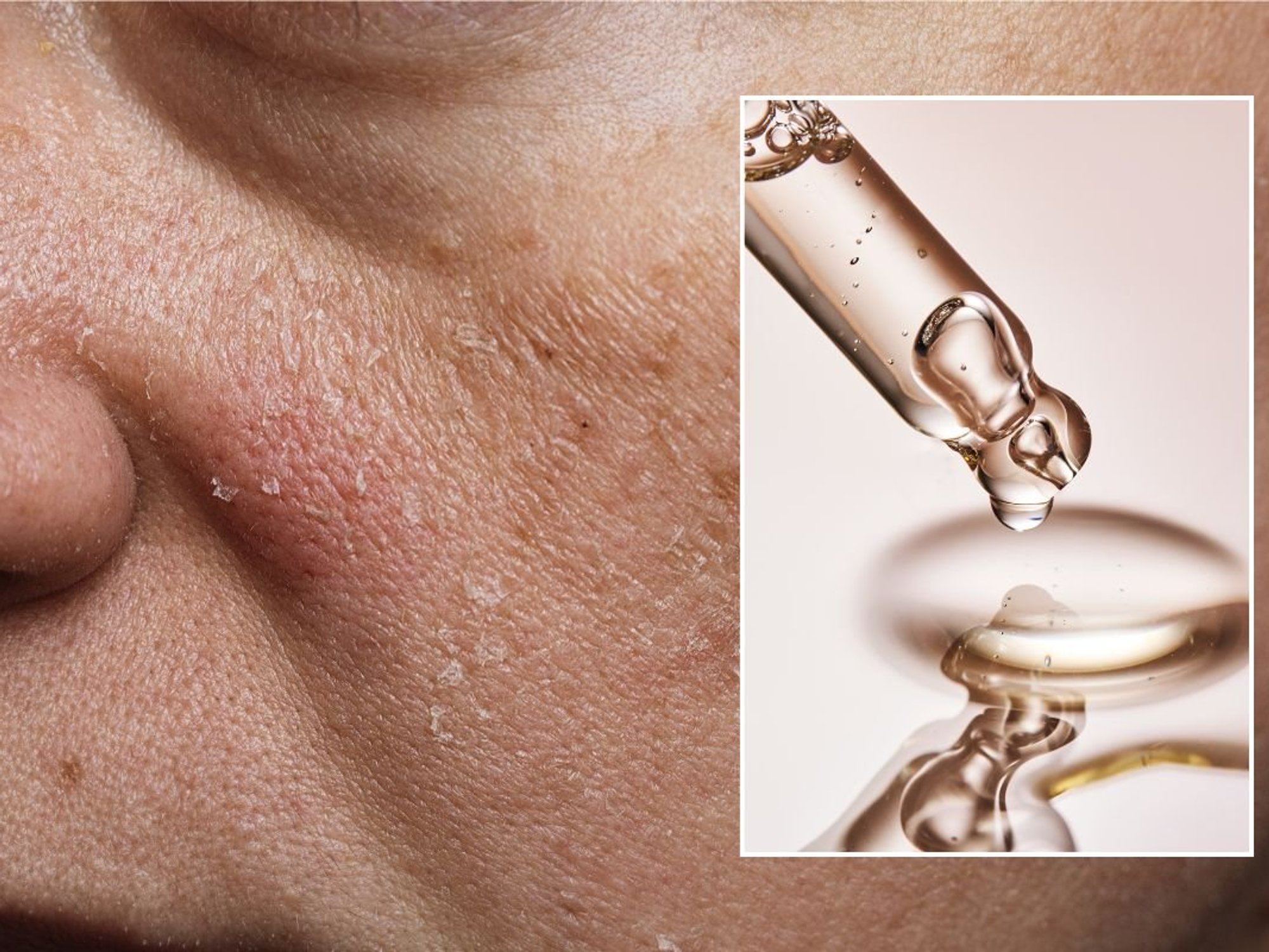 skin care