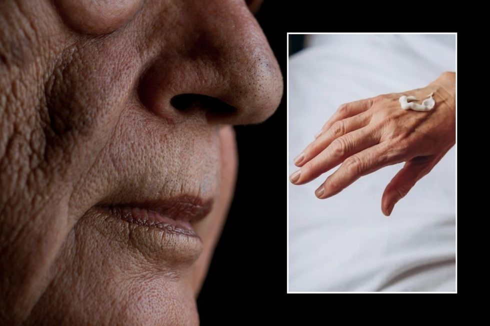 skin pores