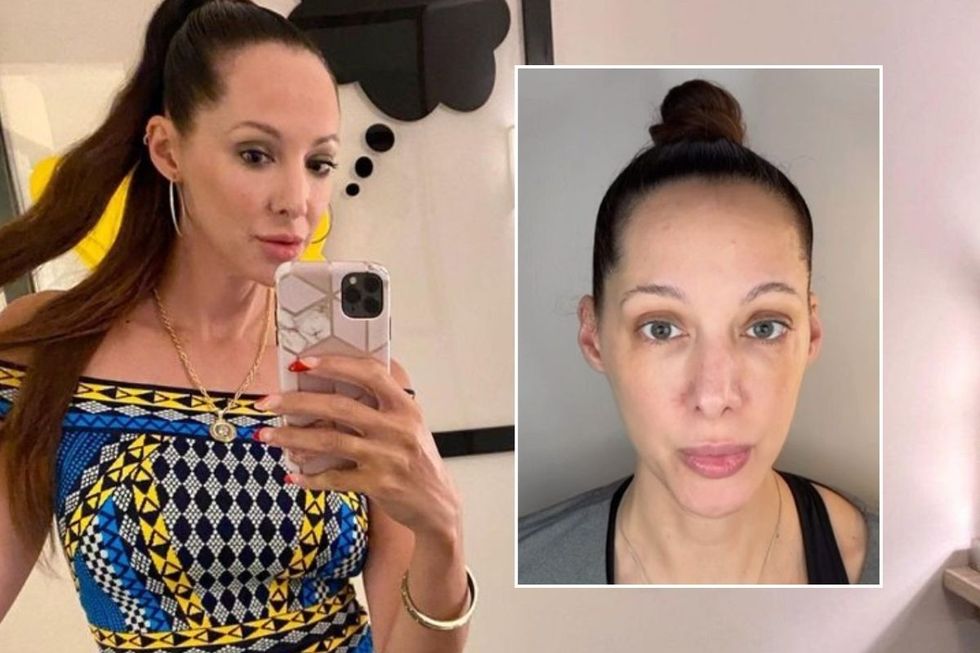 skin quality over 50