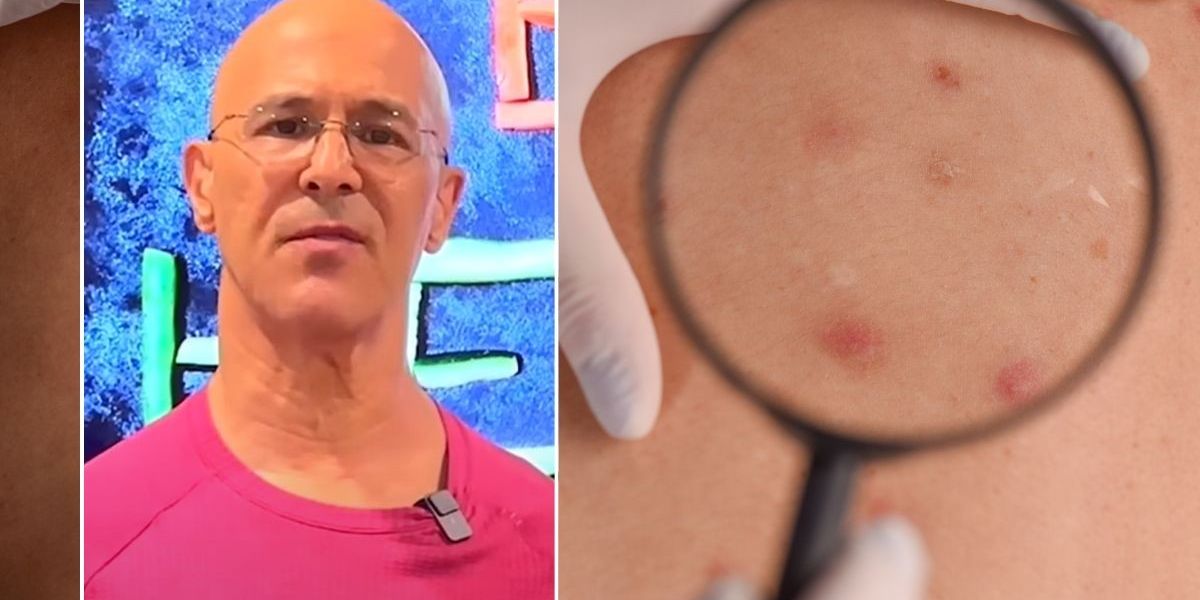 NextImg:Got skin tags? Expert warns growths could be 'notable side effect' of common dietary choice