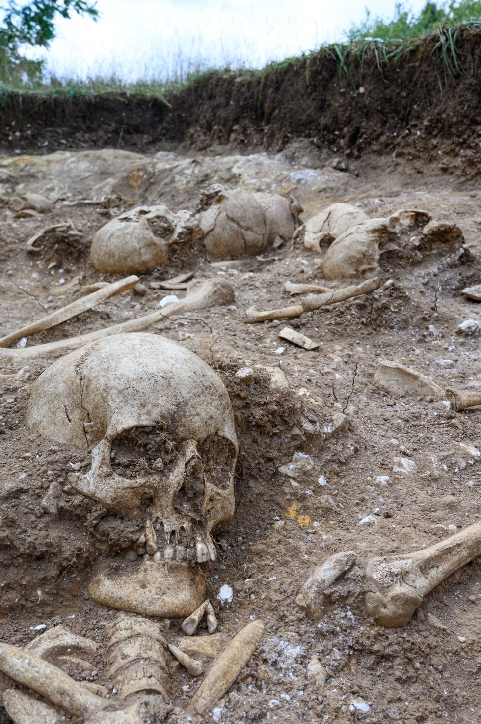 Skulls discovered by University of Cambridge students