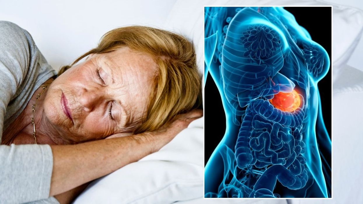 SLEEPING WOMAN AND STOMACH FLARE-UP ILLUSTRATION