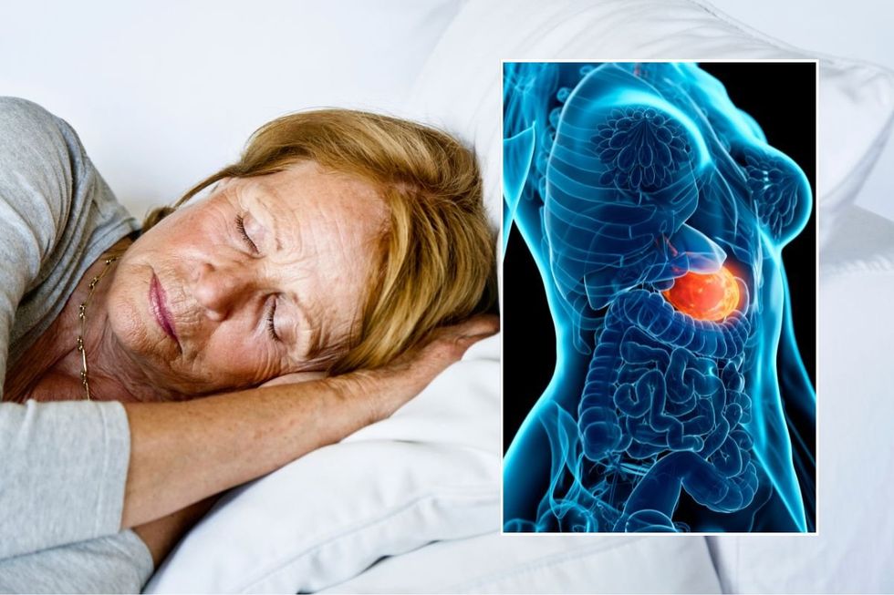 SLEEPING WOMAN AND STOMACH FLARE-UP ILLUSTRATION