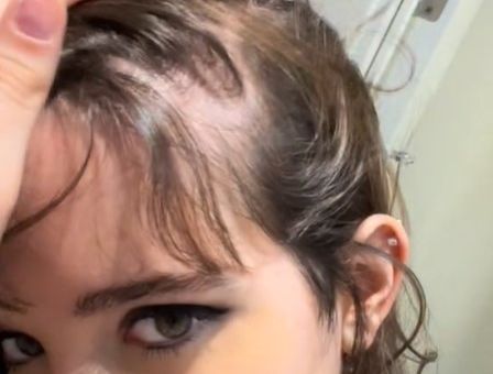 SOFIA SHOWING BALD PATCHES