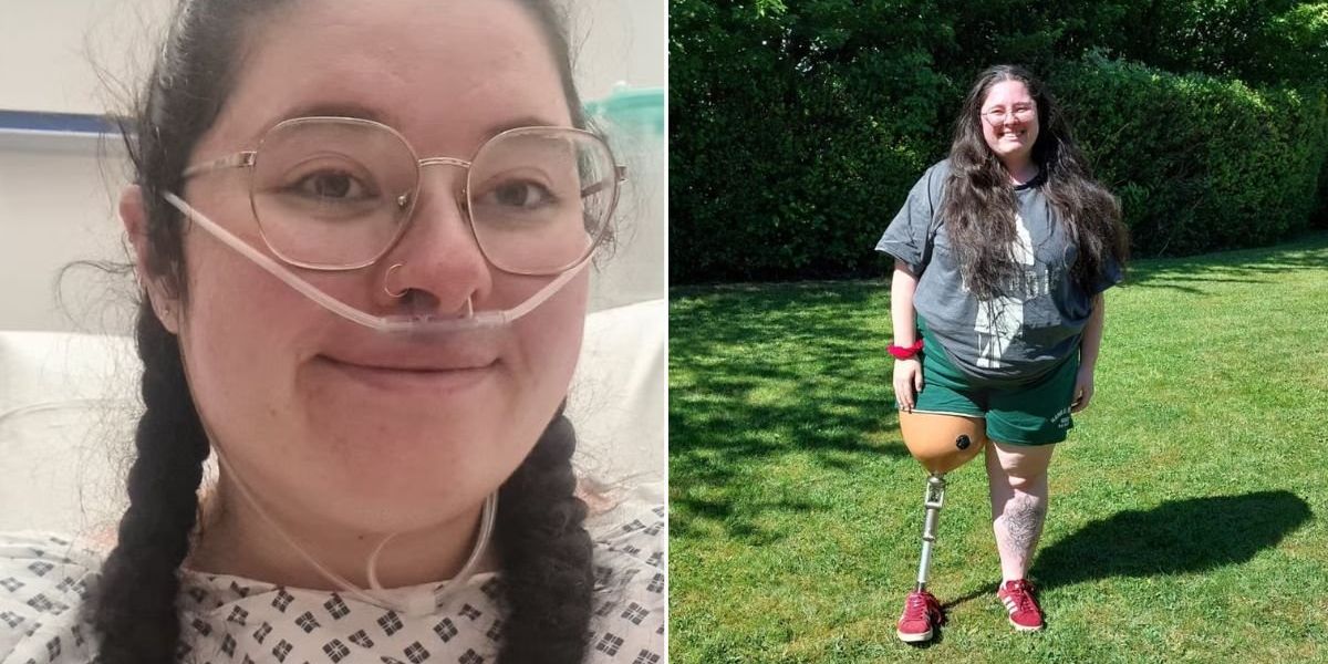 NextImg:Nurse who lost leg after mistaking tumour symptoms for sports injury shares key symptoms she missed