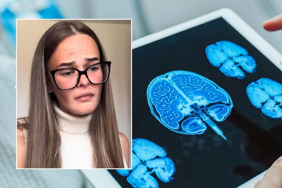 sophie headshot and brain scan stock image