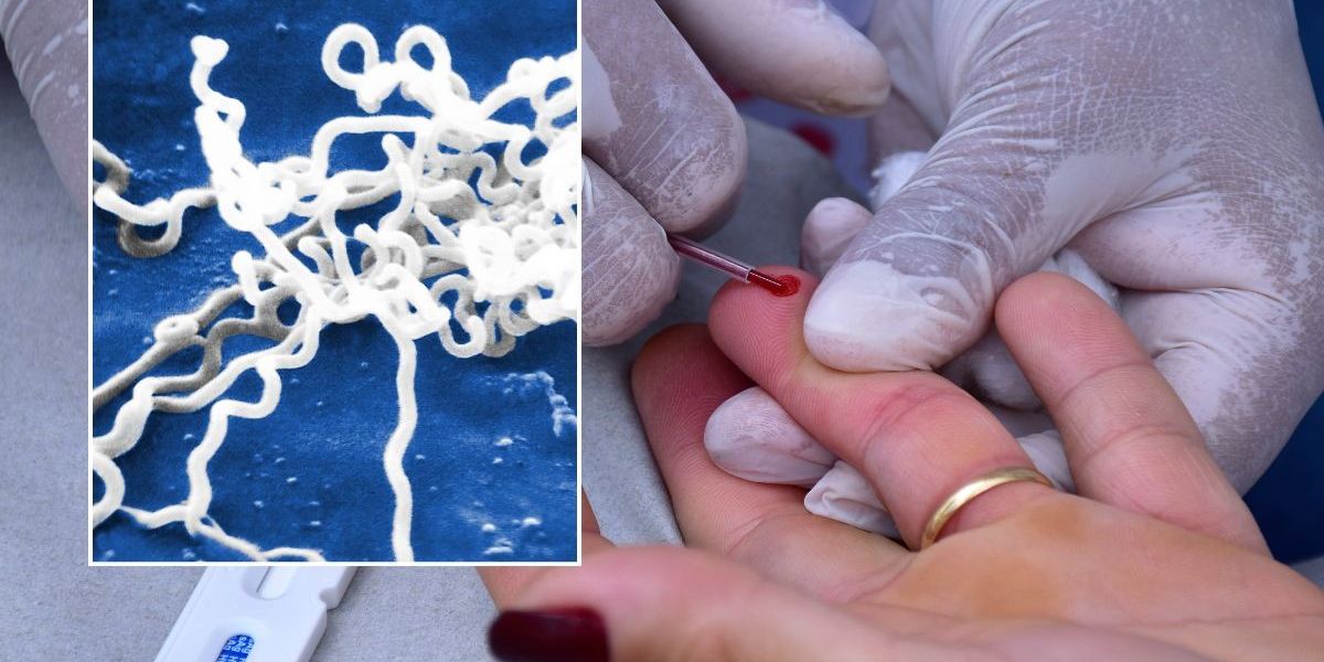 NextImg:England grapples with 19th-century STI as worst-hit areas revealed