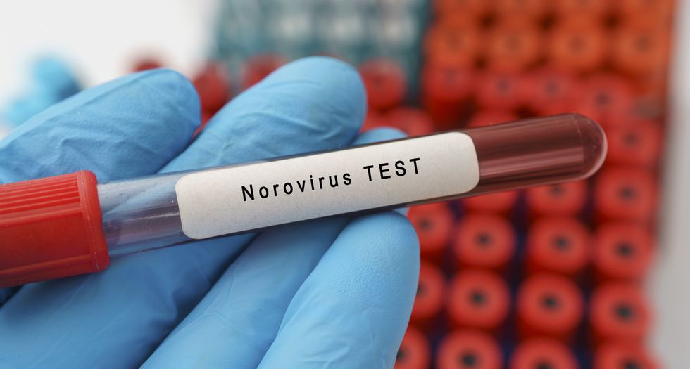 Stock image of norovirus test tube