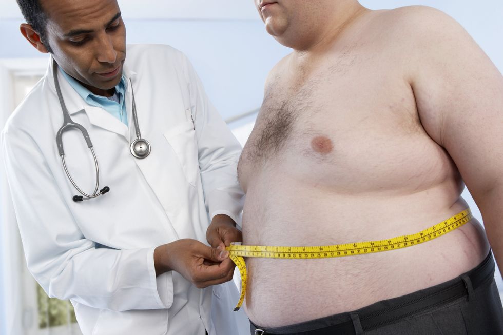 Stock image of obese man