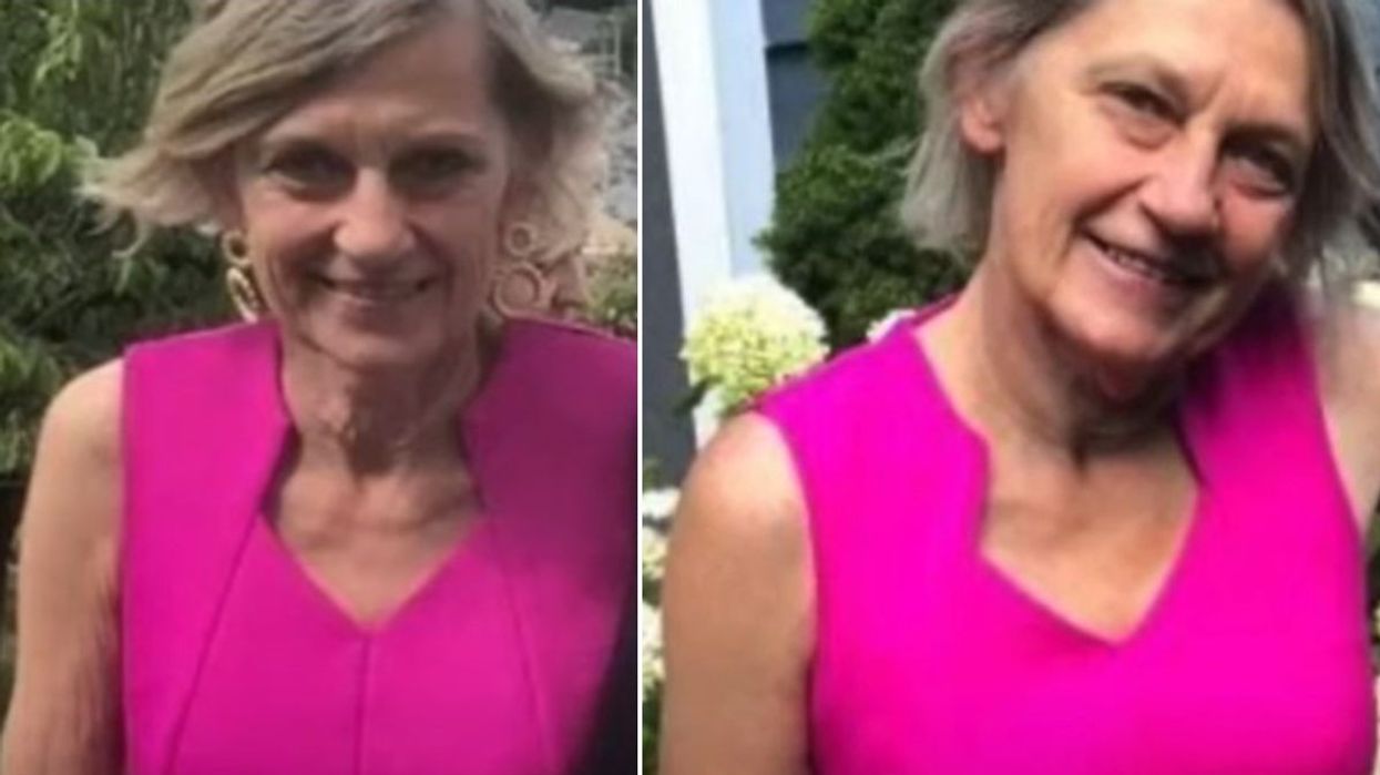 sue before and after pics