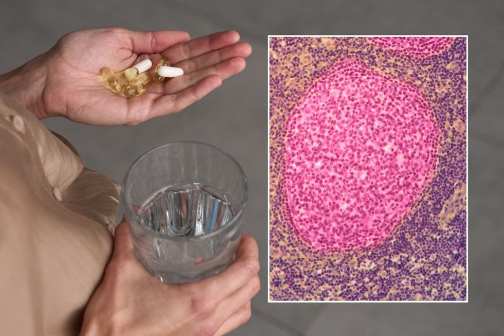 SUPPLEMENTS IN HAND