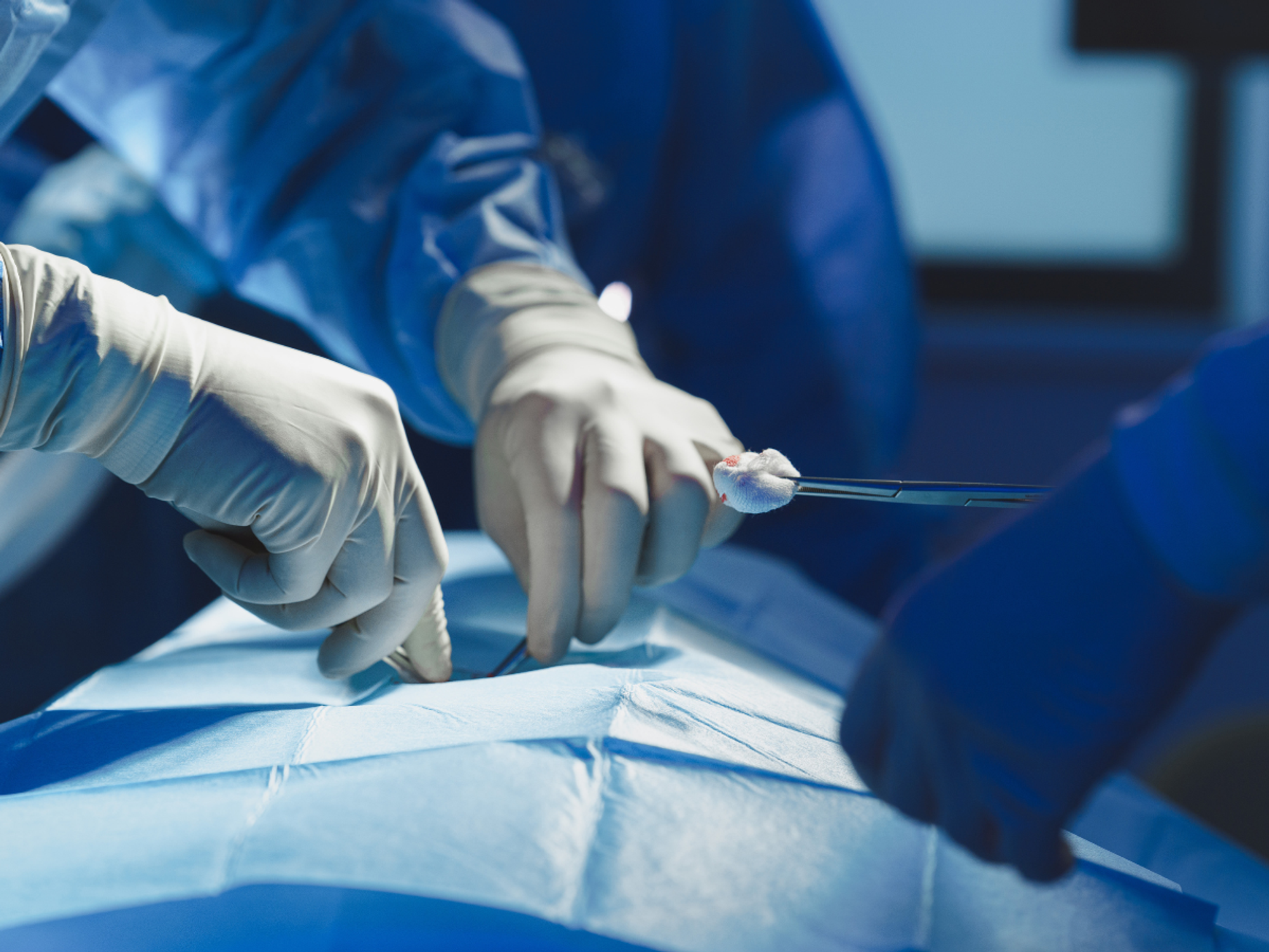 Surgery