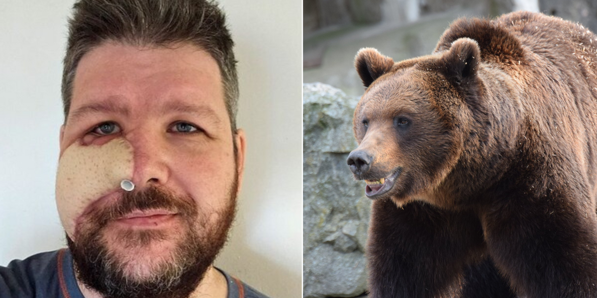 NextImg:Man takes revenge against bear that mauled him by EATING it