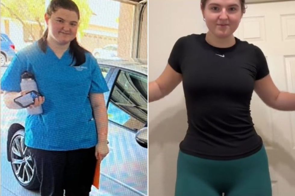 sylvia before and after