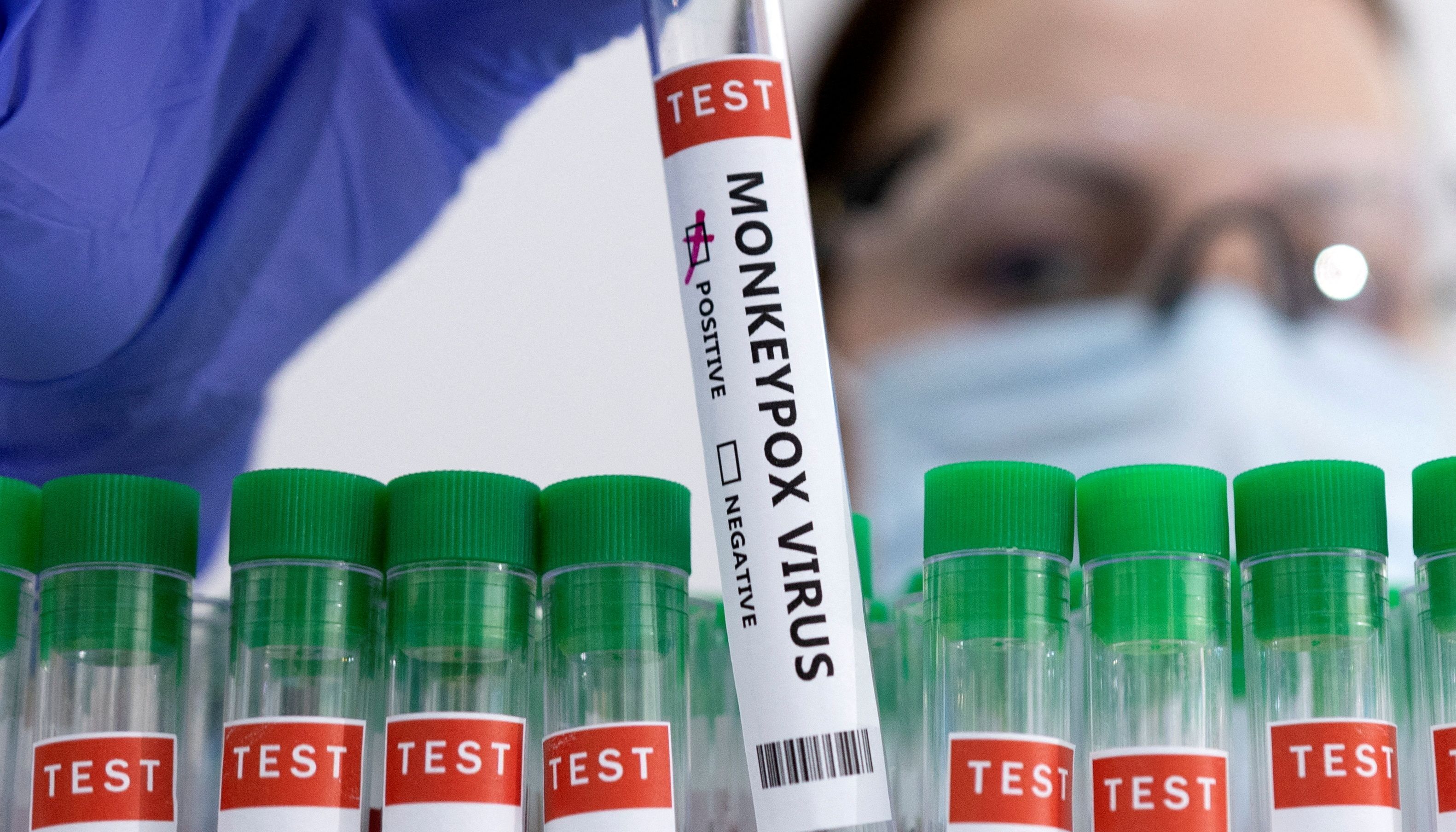 Test tubes labelled %22Monkeypox virus positive%22 are seen in this illustration.