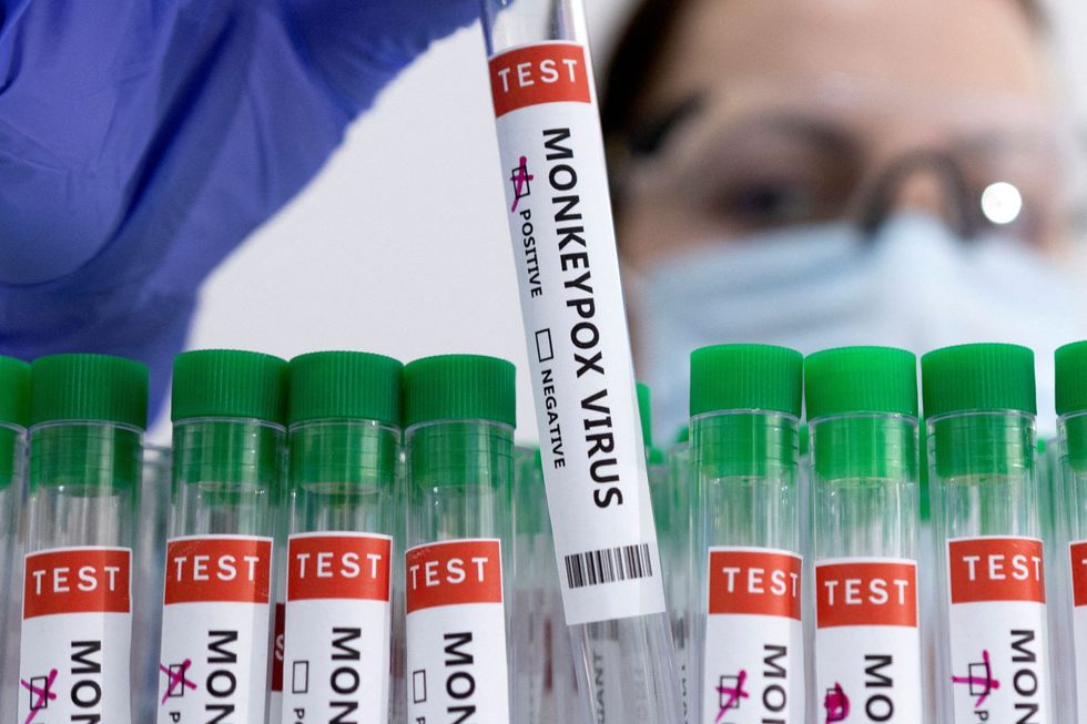 Test tubes labelled \%22Monkeypox virus positive\%22 are seen in this illustration