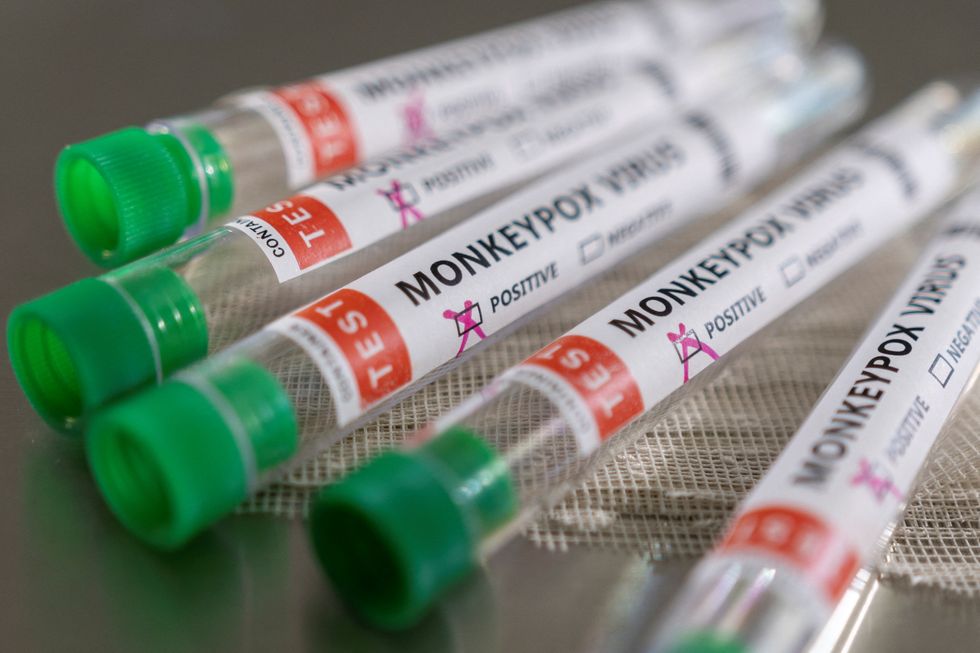 Test tubes labelled \%22Monkeypox virus positive\%22