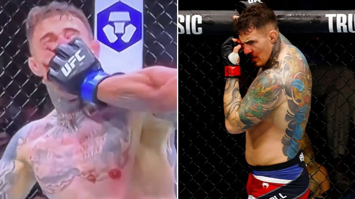 Tom Aspinall suffered a gruesome injury to his eye against Cyril Gane