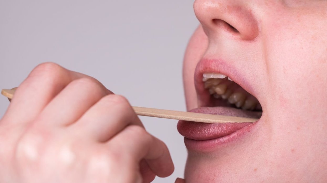 tongue mouth examination