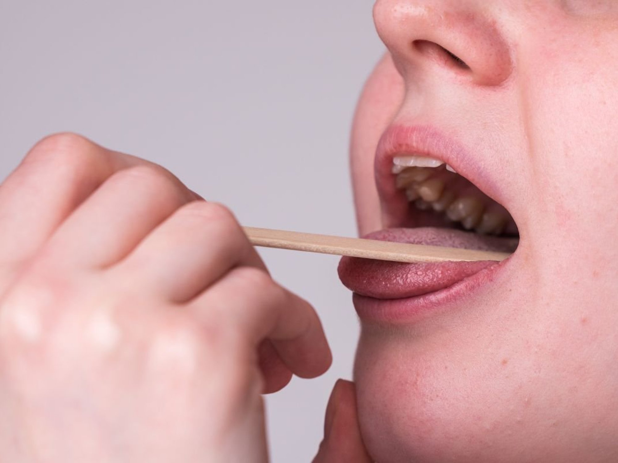 tongue mouth examination