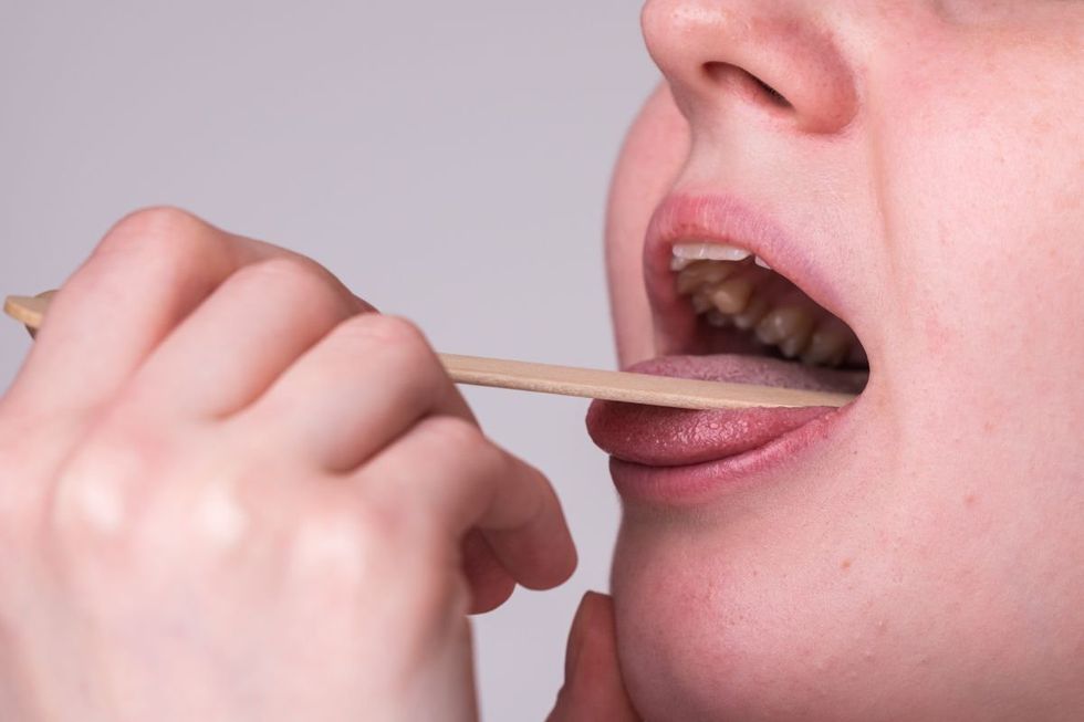 tongue mouth examination