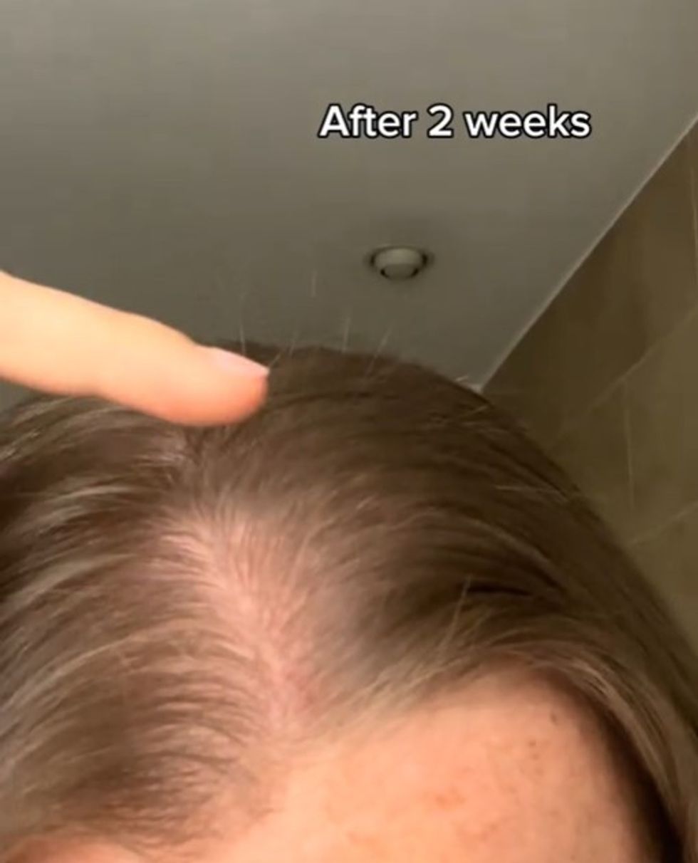 Tori Porter's hair growth transformation (two weeks of using serum)