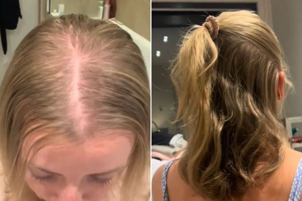 Tori Porter's hair growth transformation