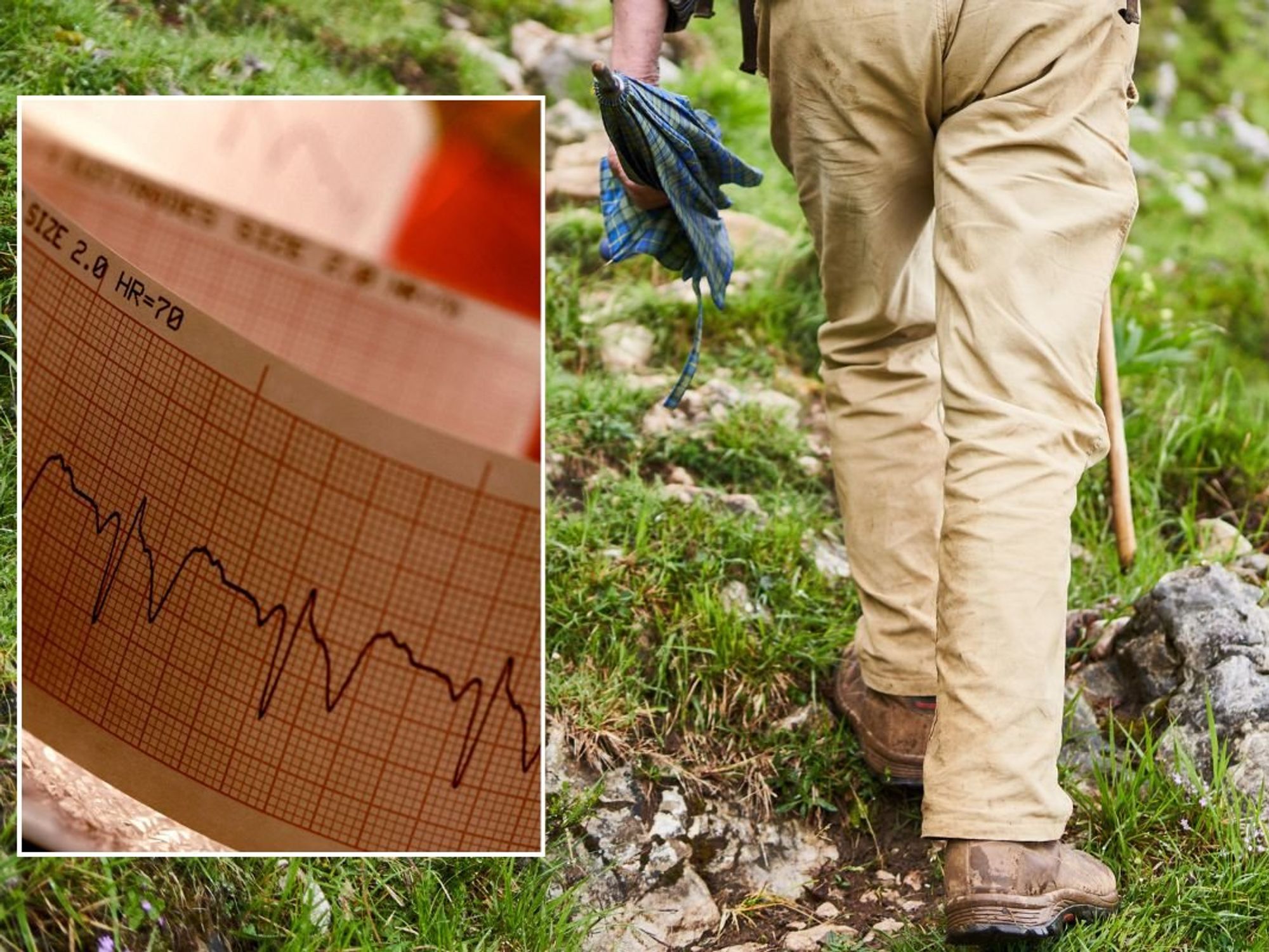 TREKKER AND ECG PRINT