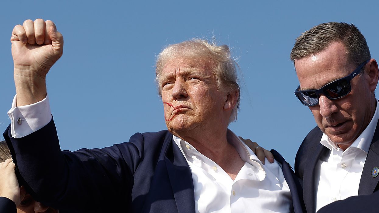 Trump's doctor gives major update on ex-President as he pours cold water on theory that bullet missed