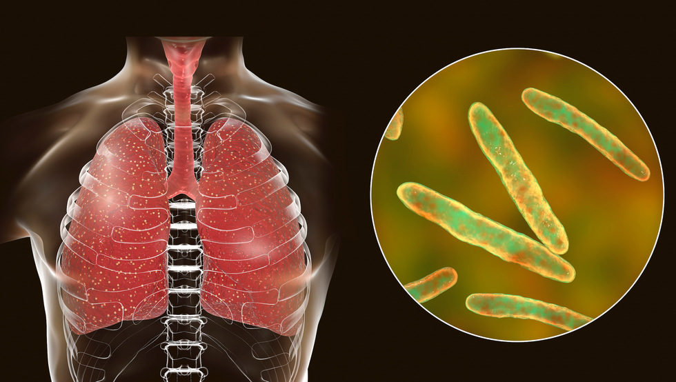 WHO sounds pandemic alarm as global’s deadliest an infection at best stage since information started