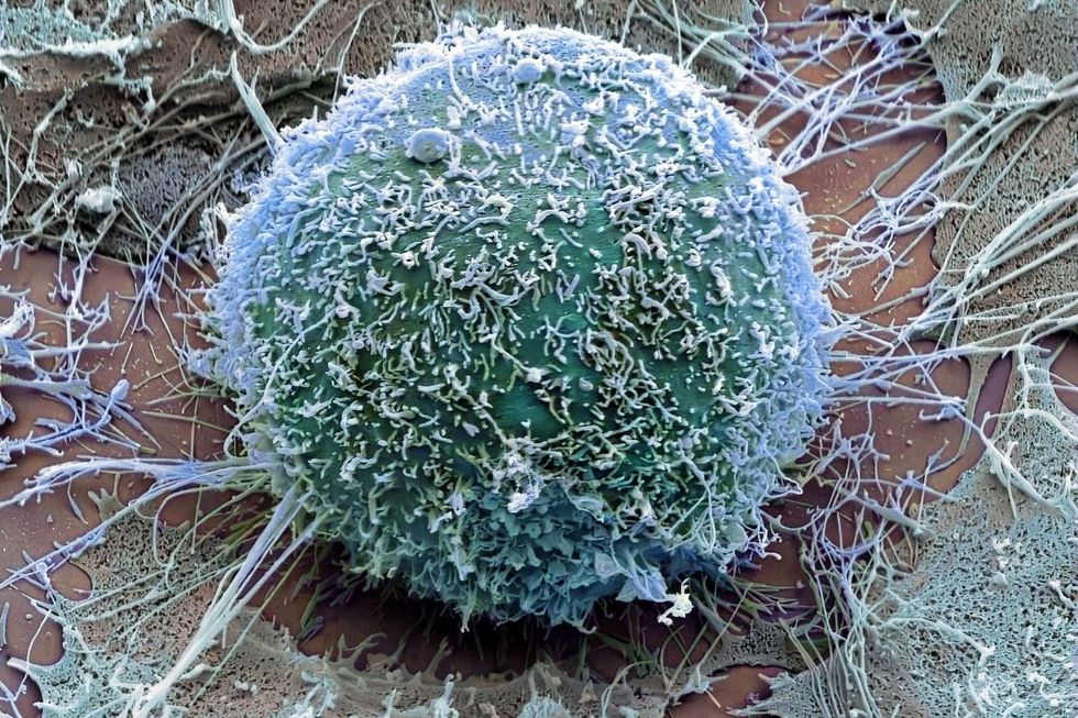 Tumour