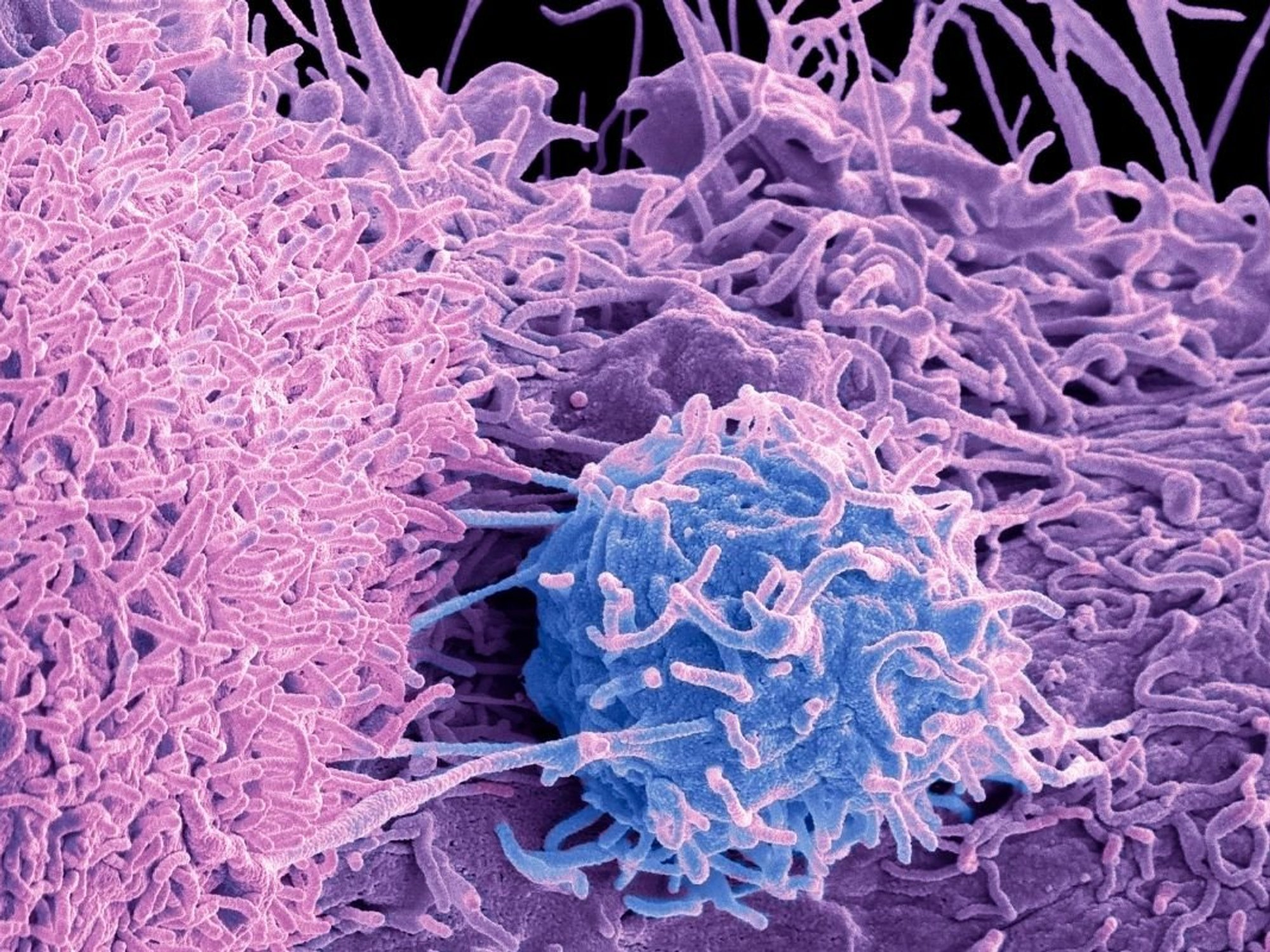 TUMOUR