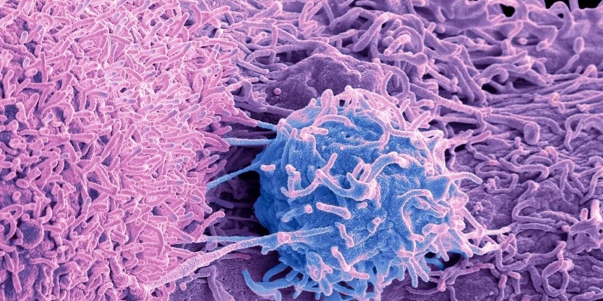 The prostate cancer warning sign men are missing in the night, according to a urologist