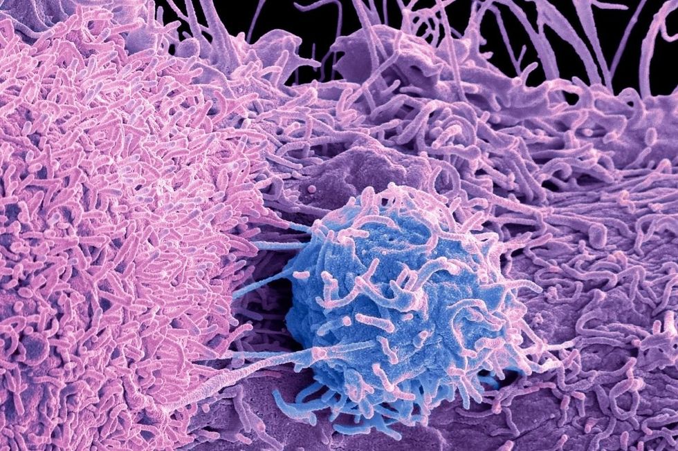 TUMOUR