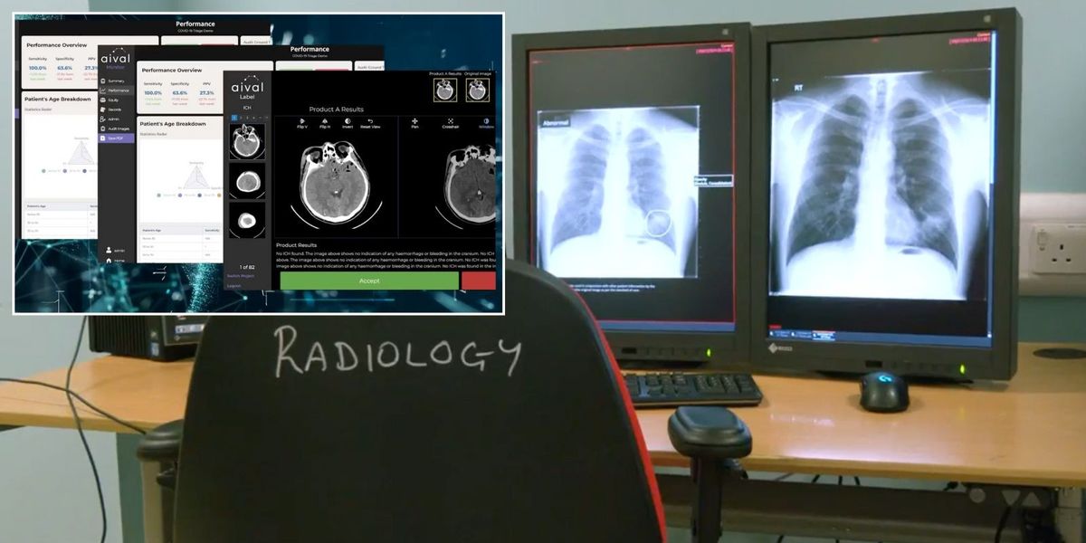 NextImg:NHS Scotland launches AI trial to help detect lung cancer and strokes in X-rays - 'Huge potential!'