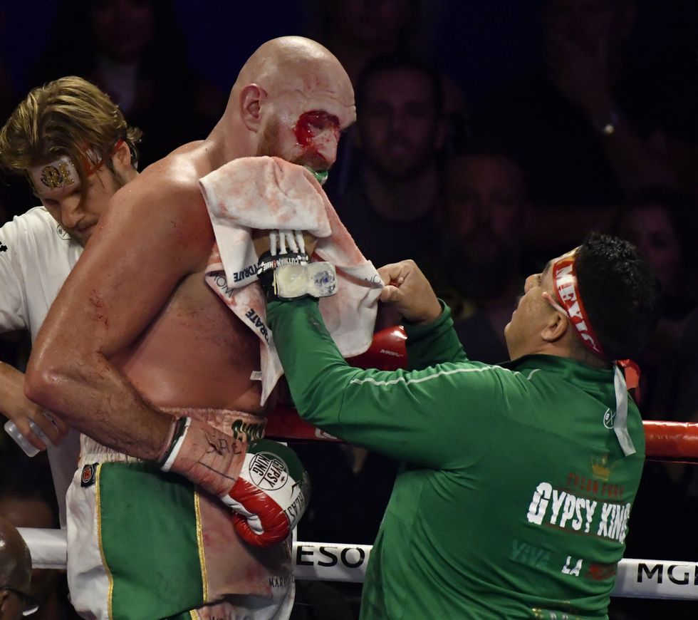 Tyson Fury and Jorge Capetillo