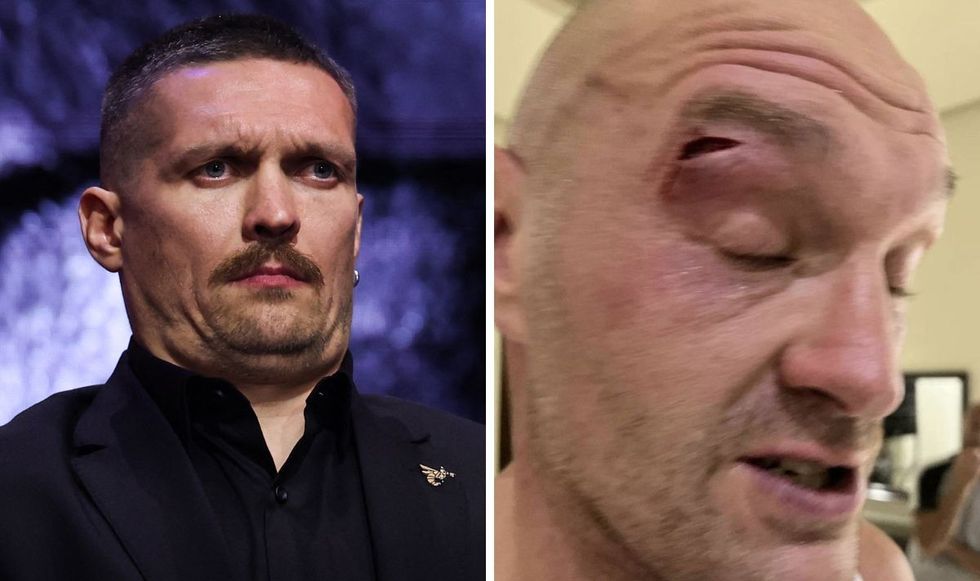 Tyson Fury faces a race against time for his cut to heal