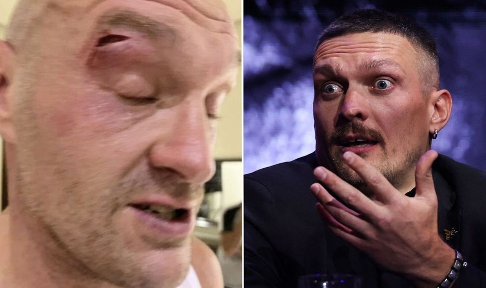 Tyson Fury suffered a nasty cut earlier this year
