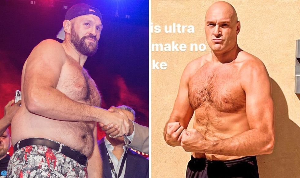 Tyson Fury