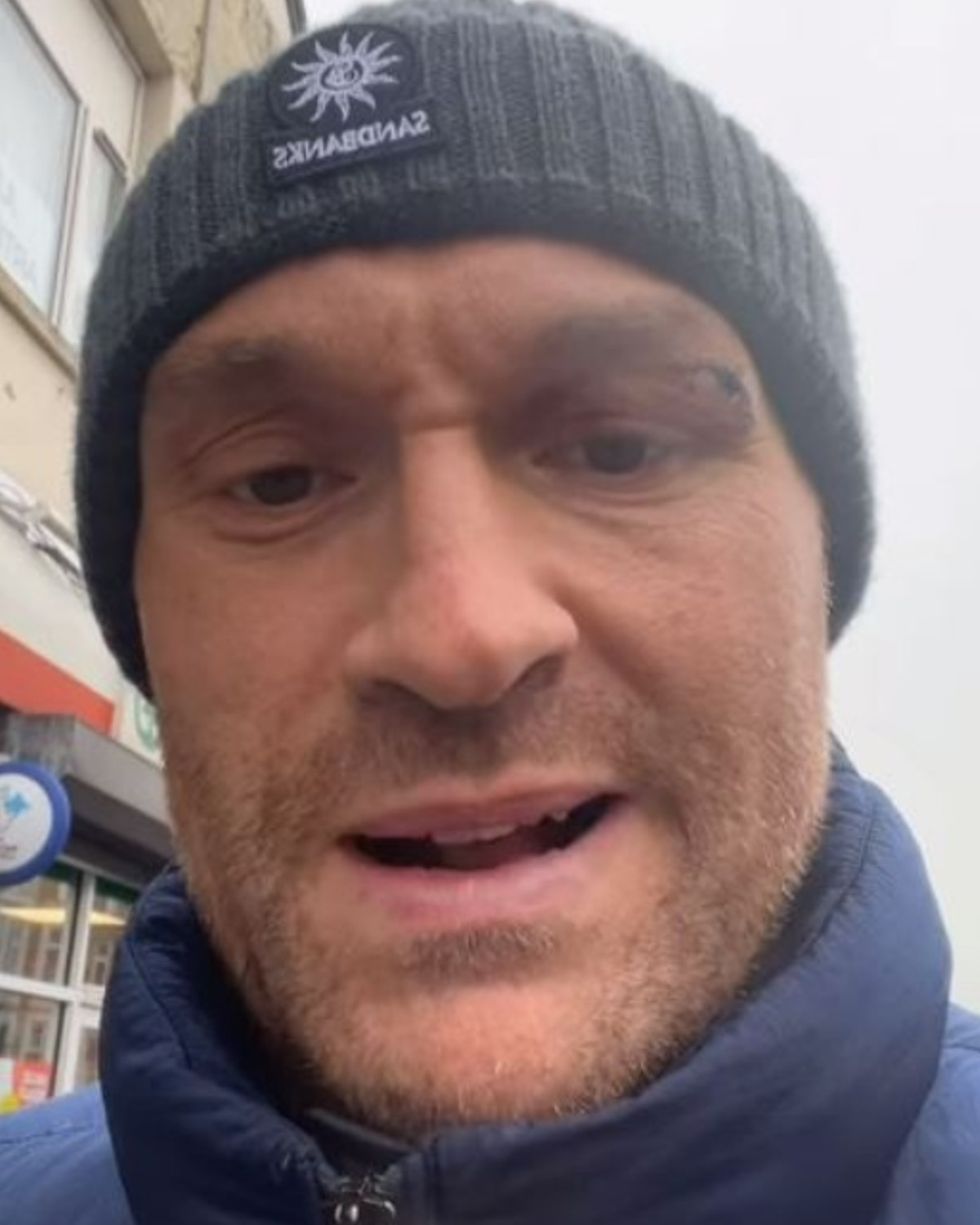 Tyson Fury