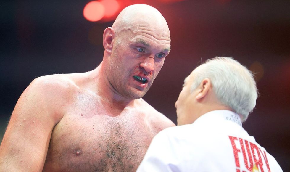 Tyson Fury