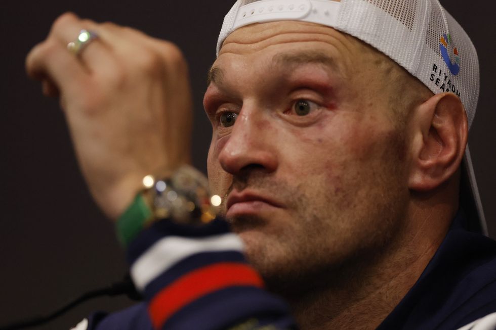 Tyson Fury