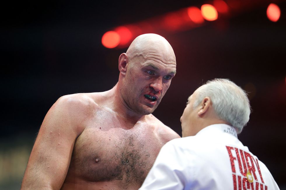 Tyson Fury