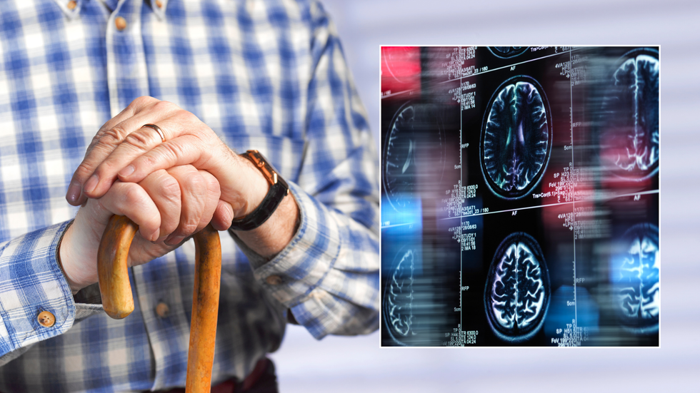 \u200bAlzheimer's is 'less likely to kill people' who hold two jobs, a study has found