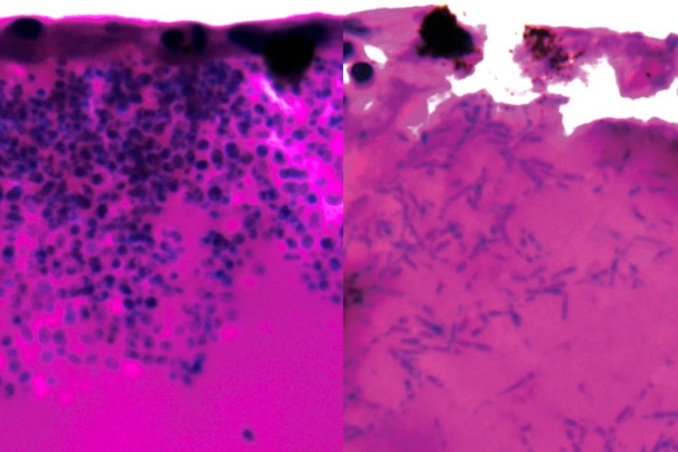 \u200bCandida auris during infection